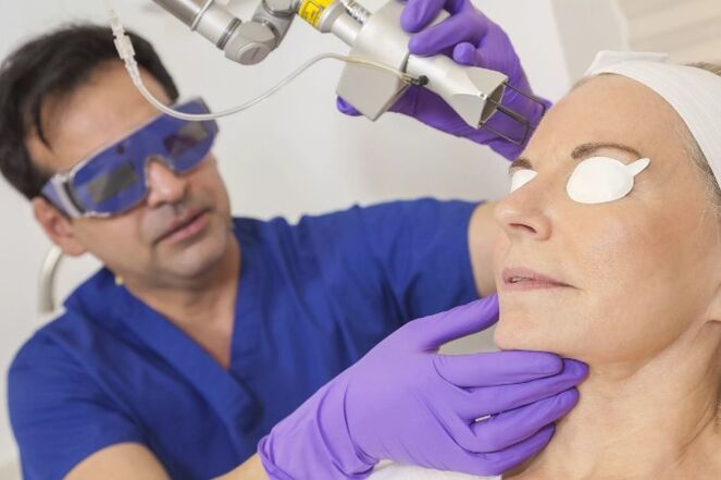 Larruazalaren gaztetzea laser batekin