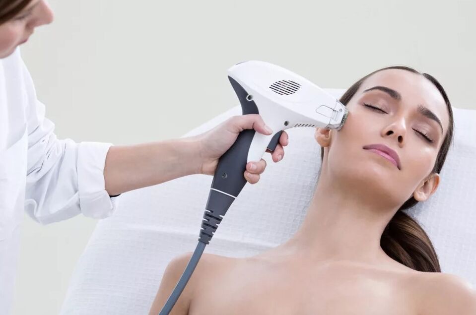 Landa-gaztetzea laser bidez